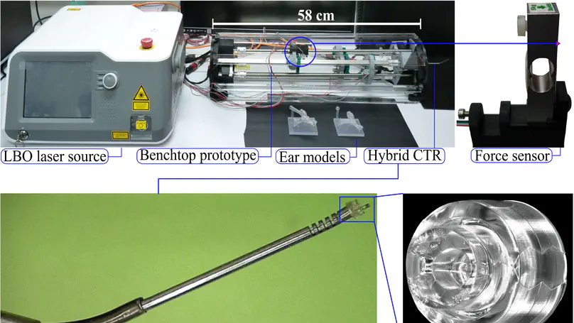 A Hybrid Concentric Tube Robot for Cholesteatoma Laser Surgery